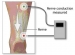 In Office Diagnostic Testing Nerve Conduction Velocity